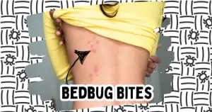  Early Signs of Bed Bugs