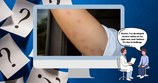 Should you see a doctor for bed bug bites